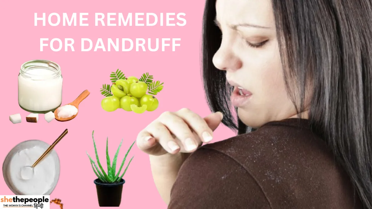 Dandruff home remedies