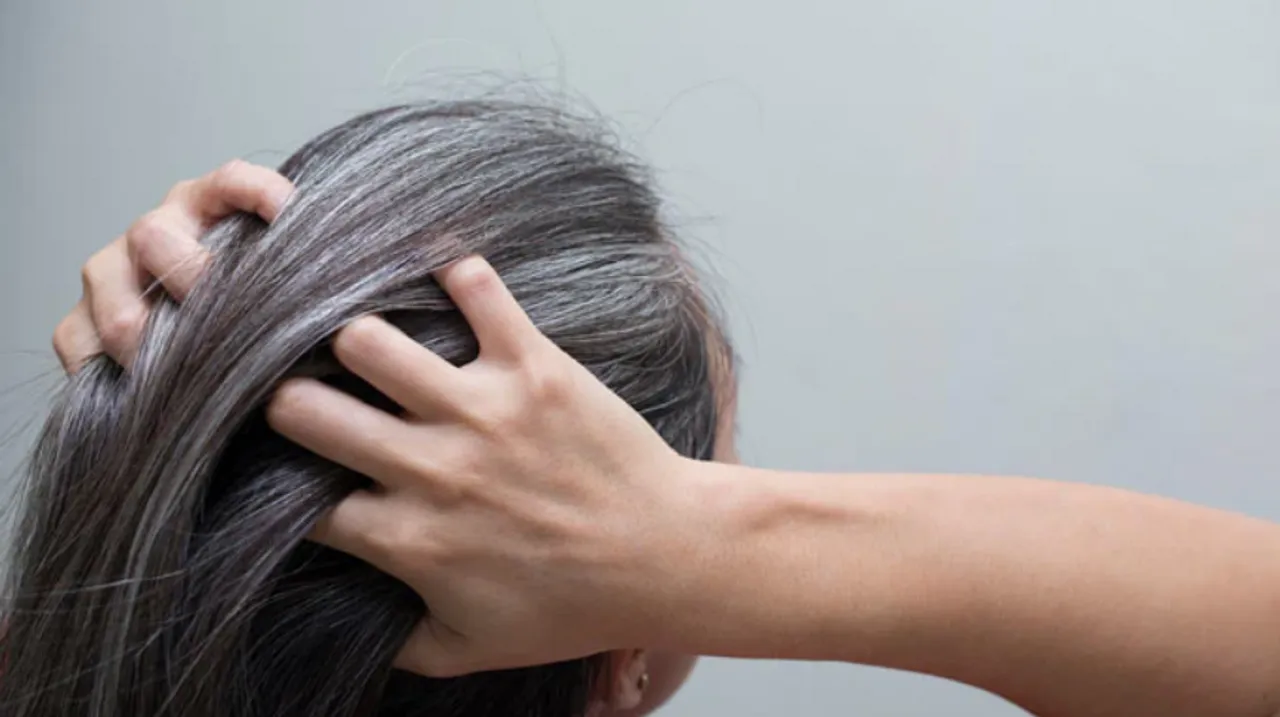Tips To Prevent Grey Hair: सफेद बालों की समस्या से पाएं छुटकारा