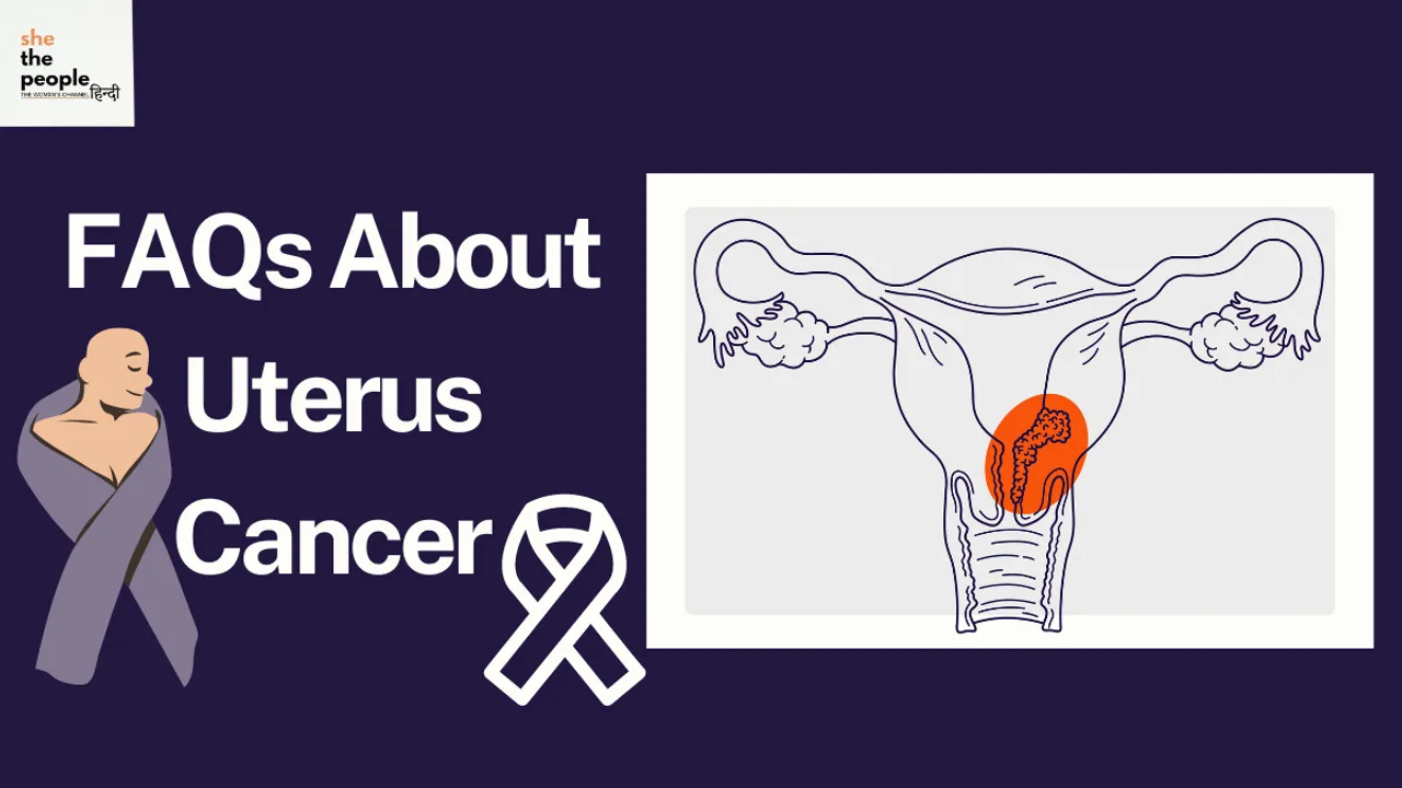 FAQs About Uterus Cancer 