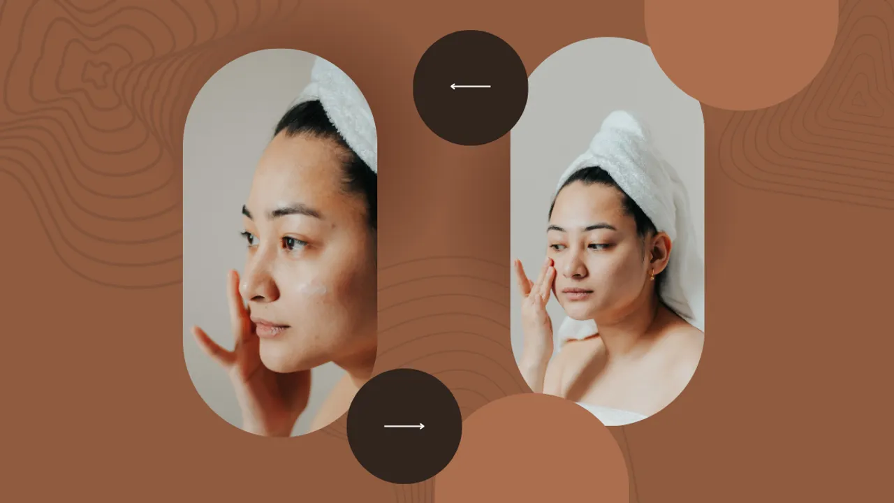face pimples (Canva)