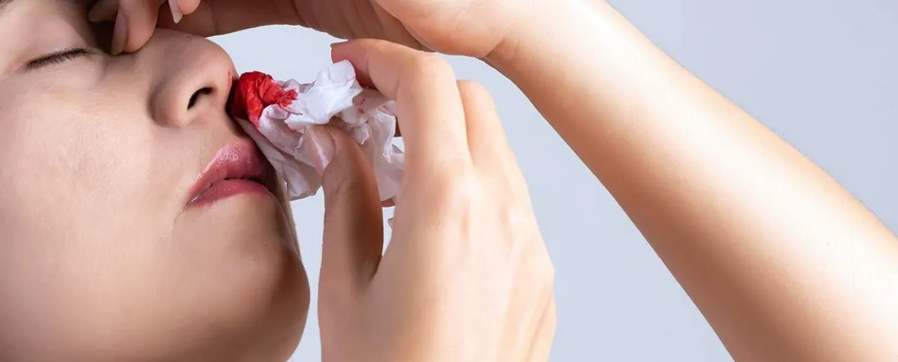 Bleeding Nose: गर्मियों में नाक से खून आने पर करें ये घरेलू उपचार