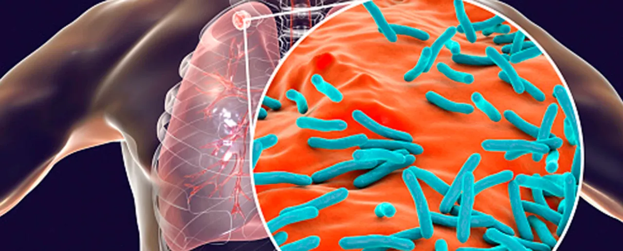 TB Or Tuberculosis: टीबी के लक्षणों पर तुरंत करें डॉक्टर से संपर्क