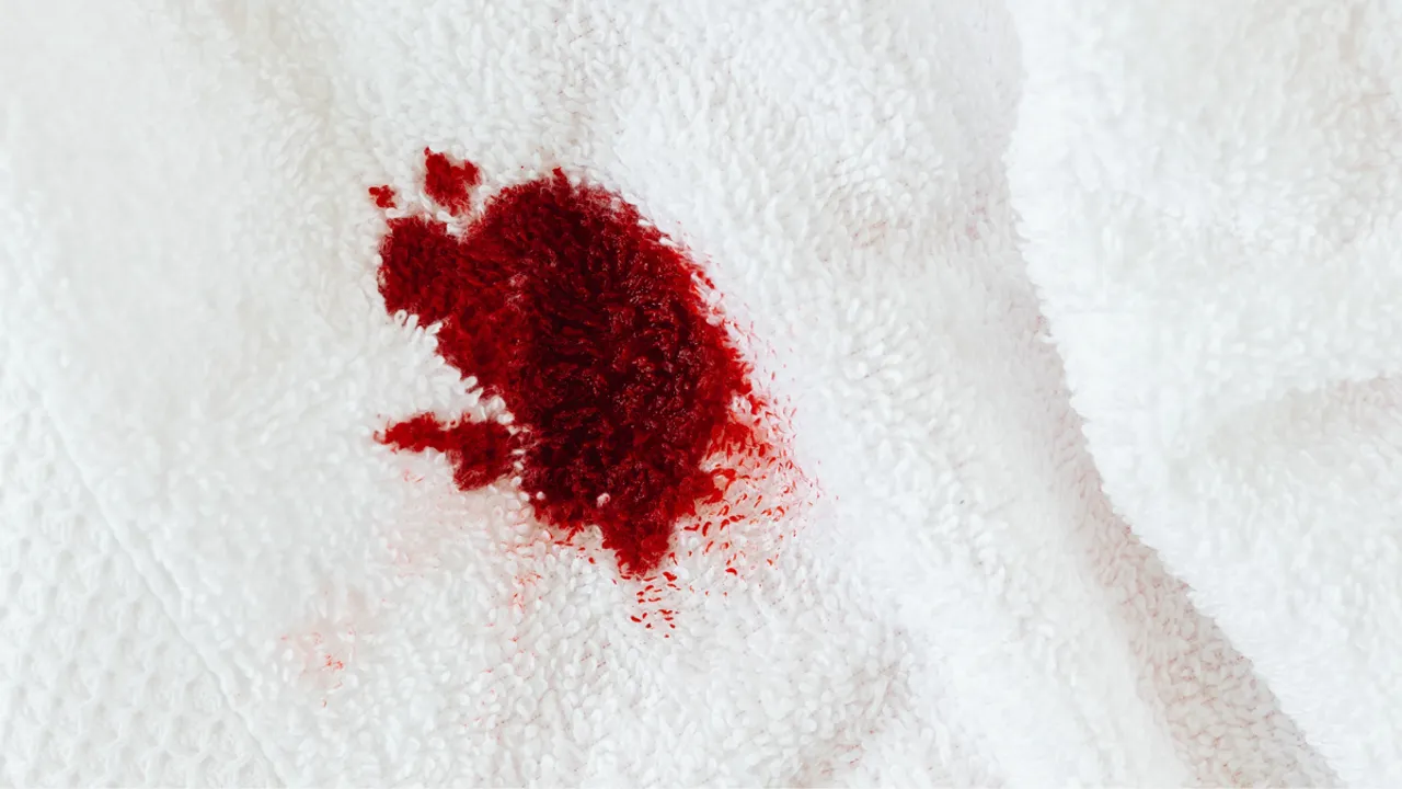 Bleeding After Sex: सेक्स के बाद ब्लीडिंग होने के क्या कारण हो सकते हैं?