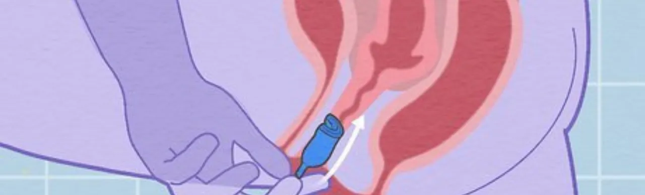 Menstrual Cup: जानिए मेंस्ट्रुअल कप के कुछ मिथक कुछ फैक्ट के बारे में