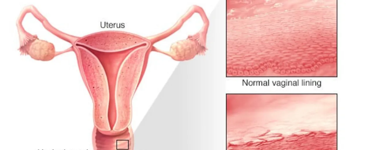 Vagina और Vulva में क्या अंतर है, जानें एक्सपर्ट्स से