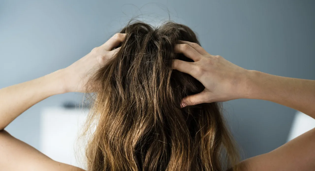 Hairfall Issue: जानें कैसे कम कर सकते हैं हेयर फॉल को