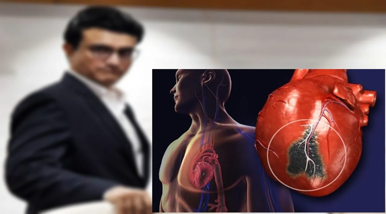 sourav ganguly, sourav ganguly heart attack,