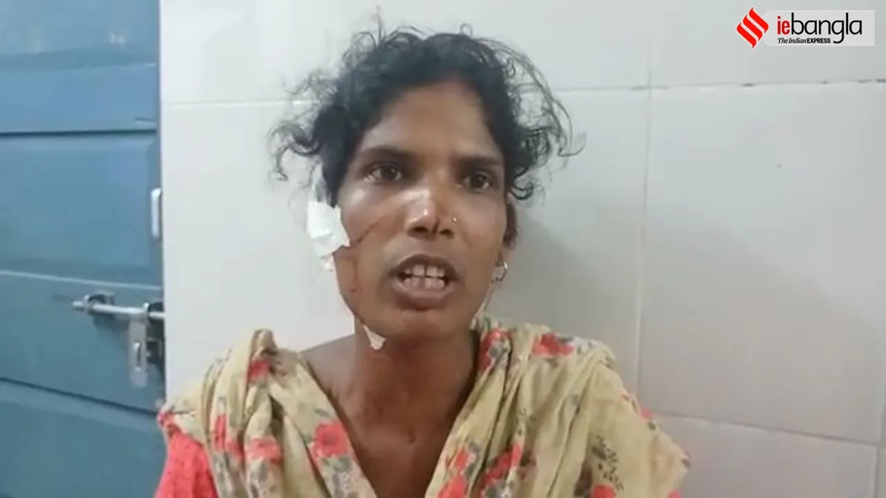 mother in-law bit the daughter in laws ear in Malda