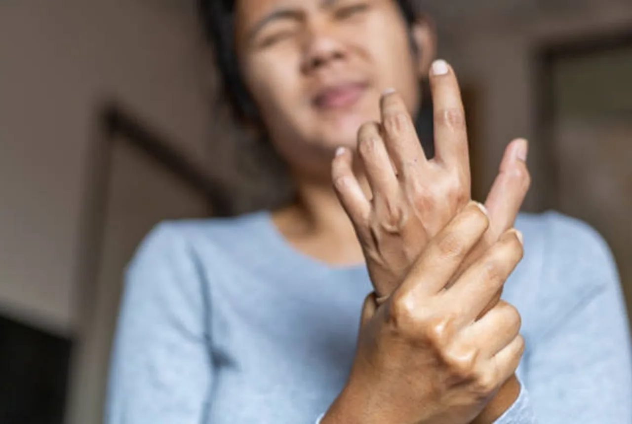 arthritis