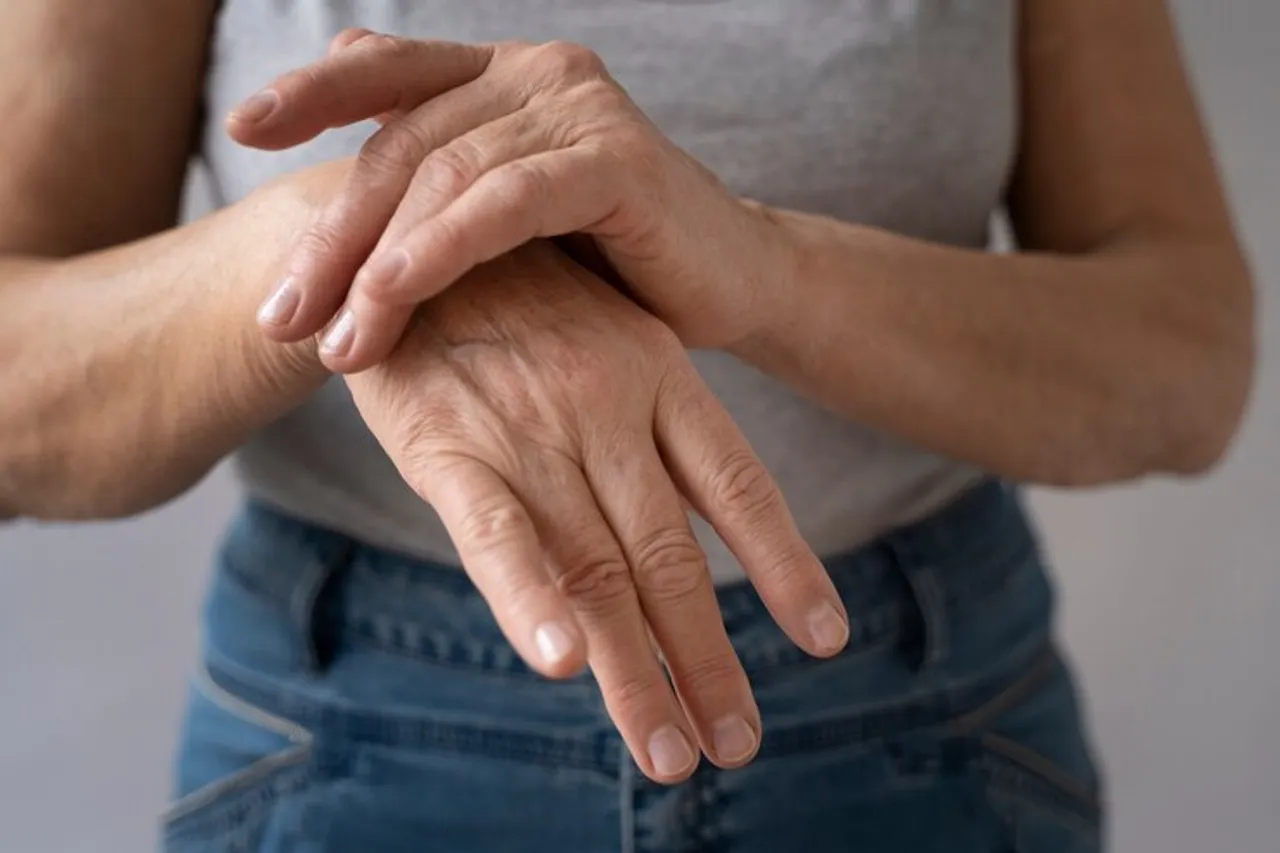 rheumatoid arthritis 