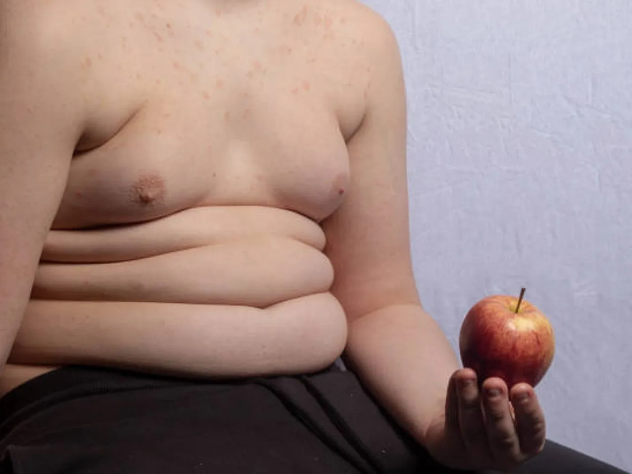 children obesity