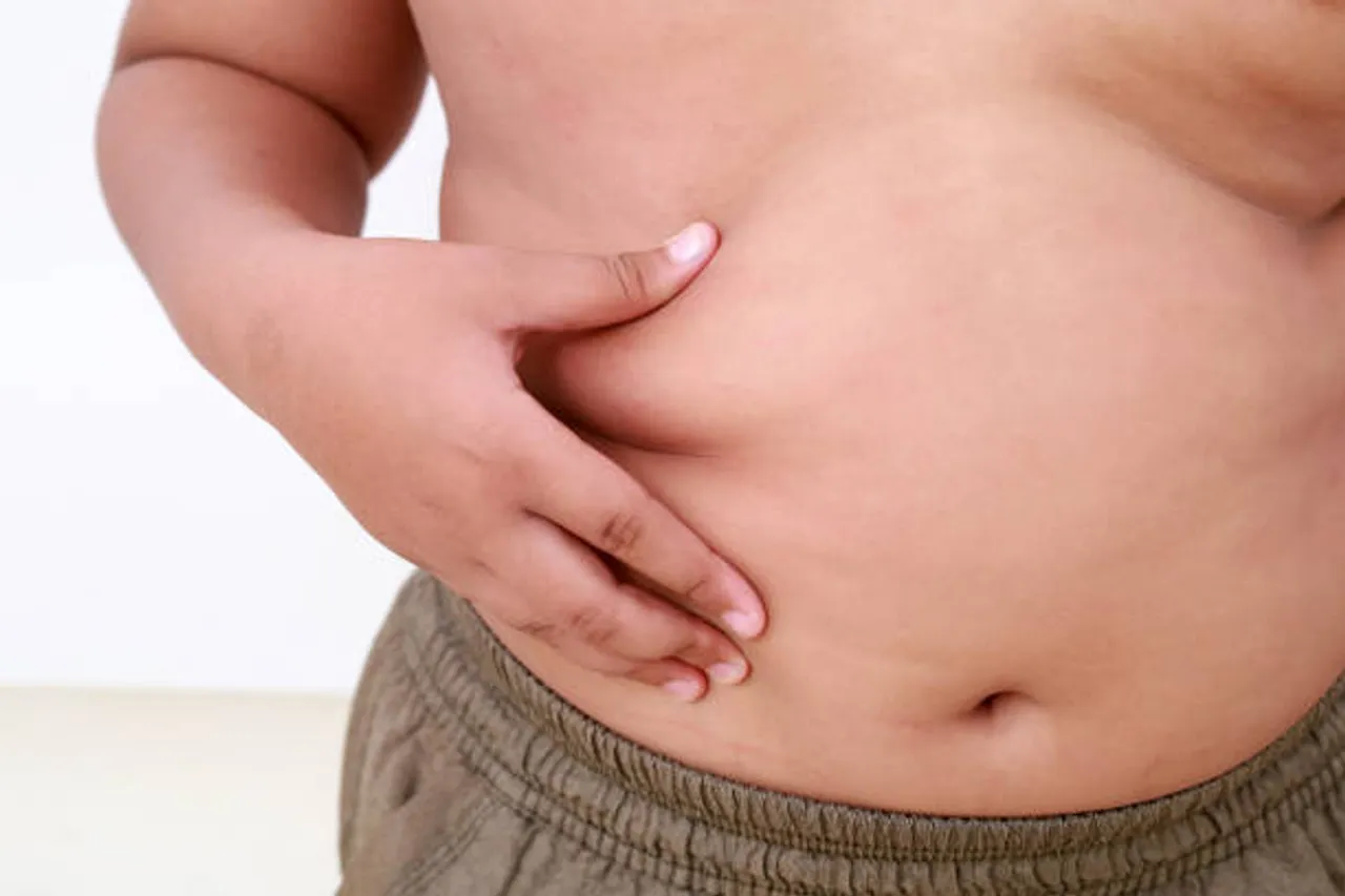 children obesity