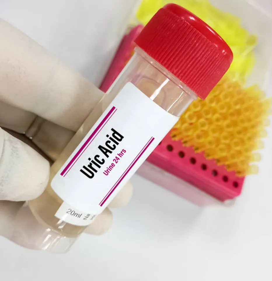 uric acid