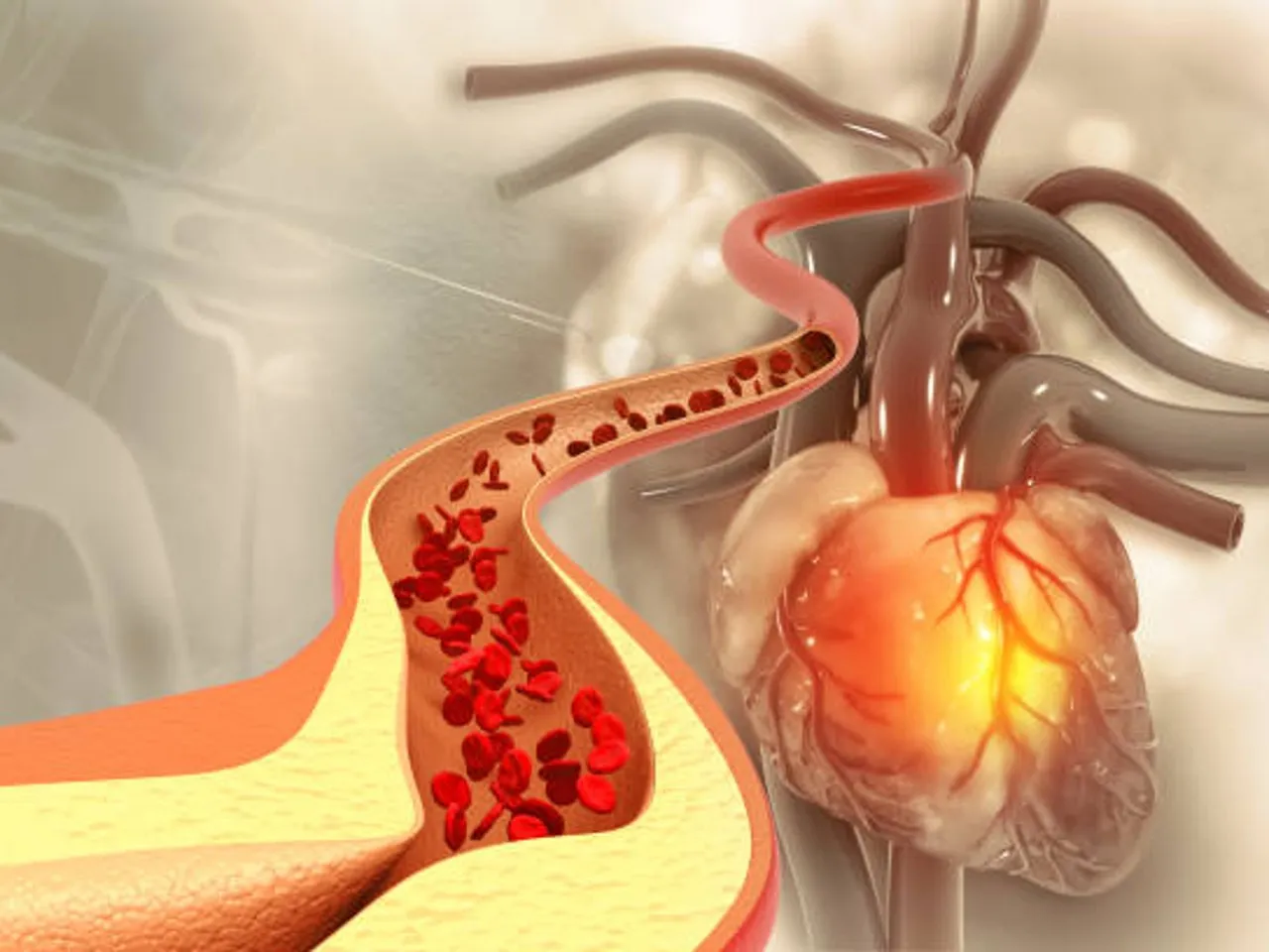 cholesterol