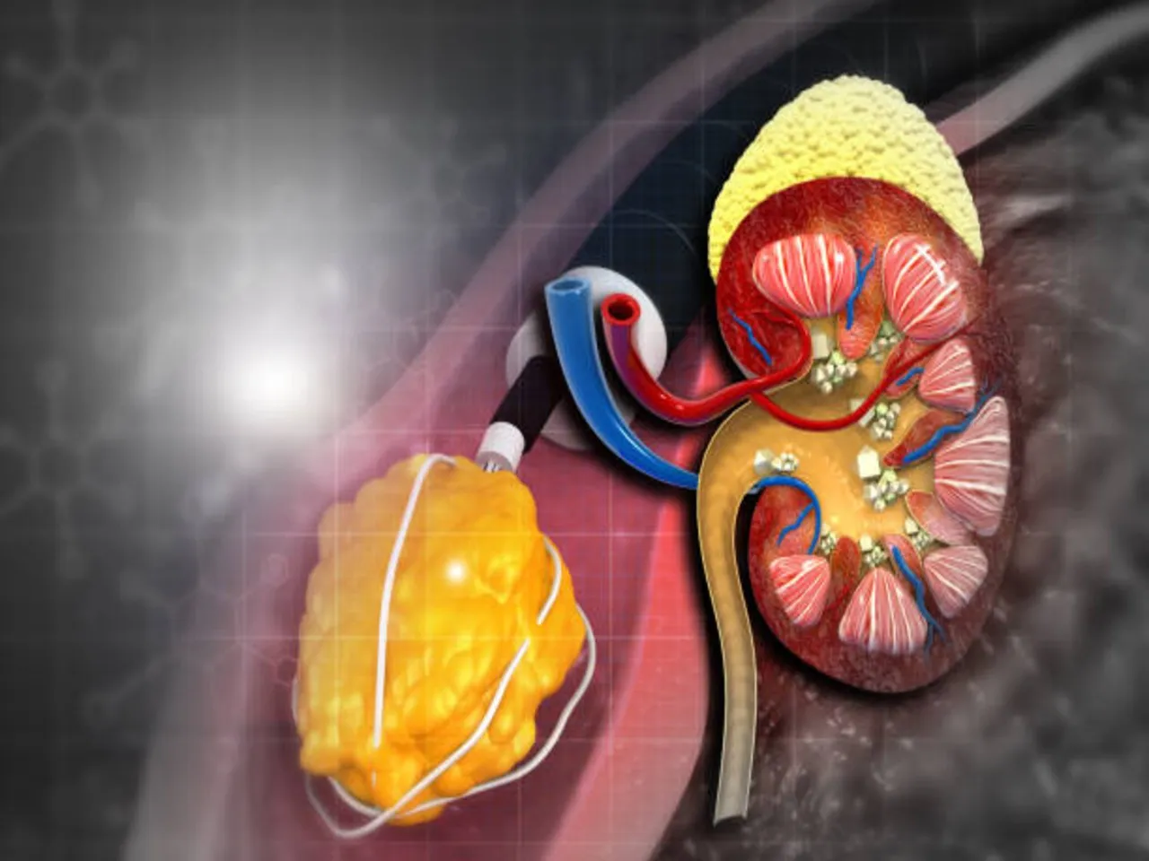 kidney