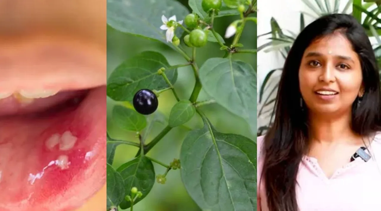 Mouth ulcer