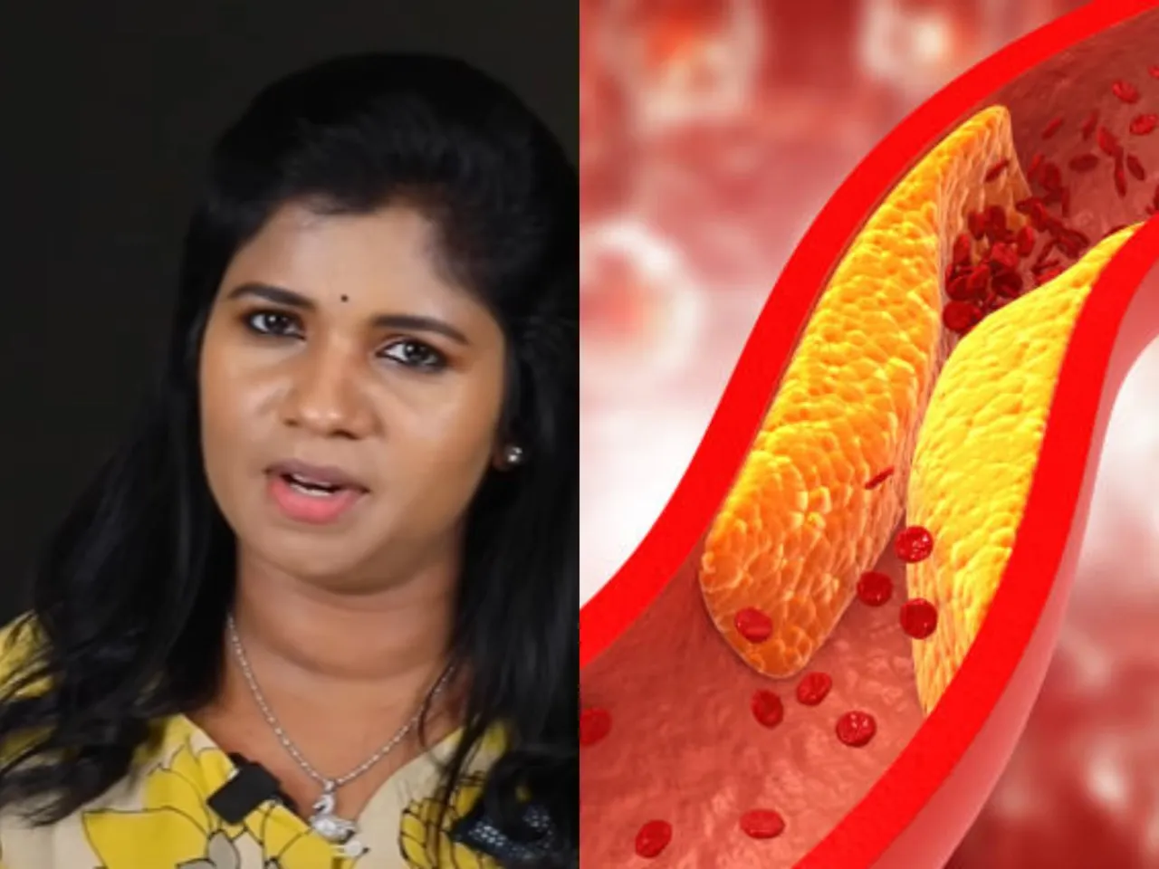 cholesterol