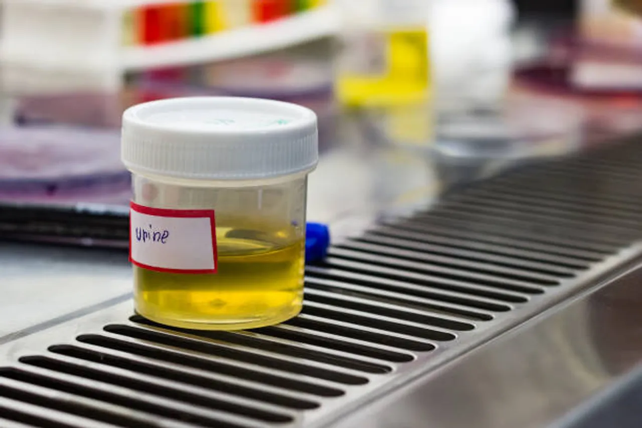urine