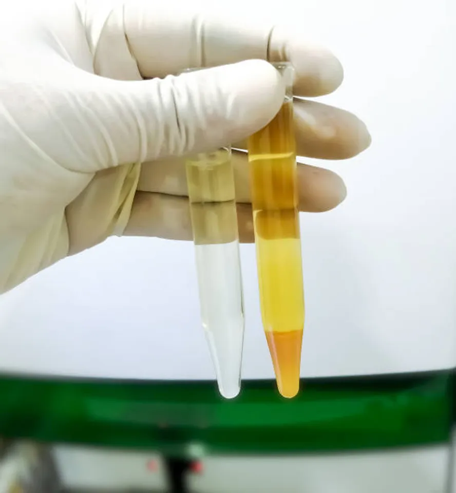 urine
