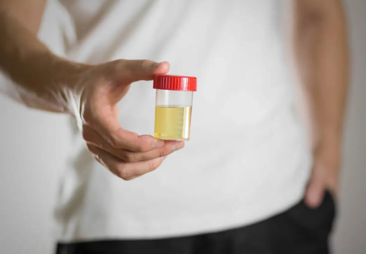 urine