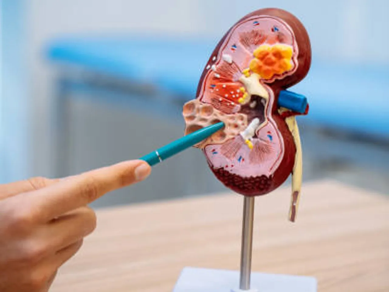 kidney