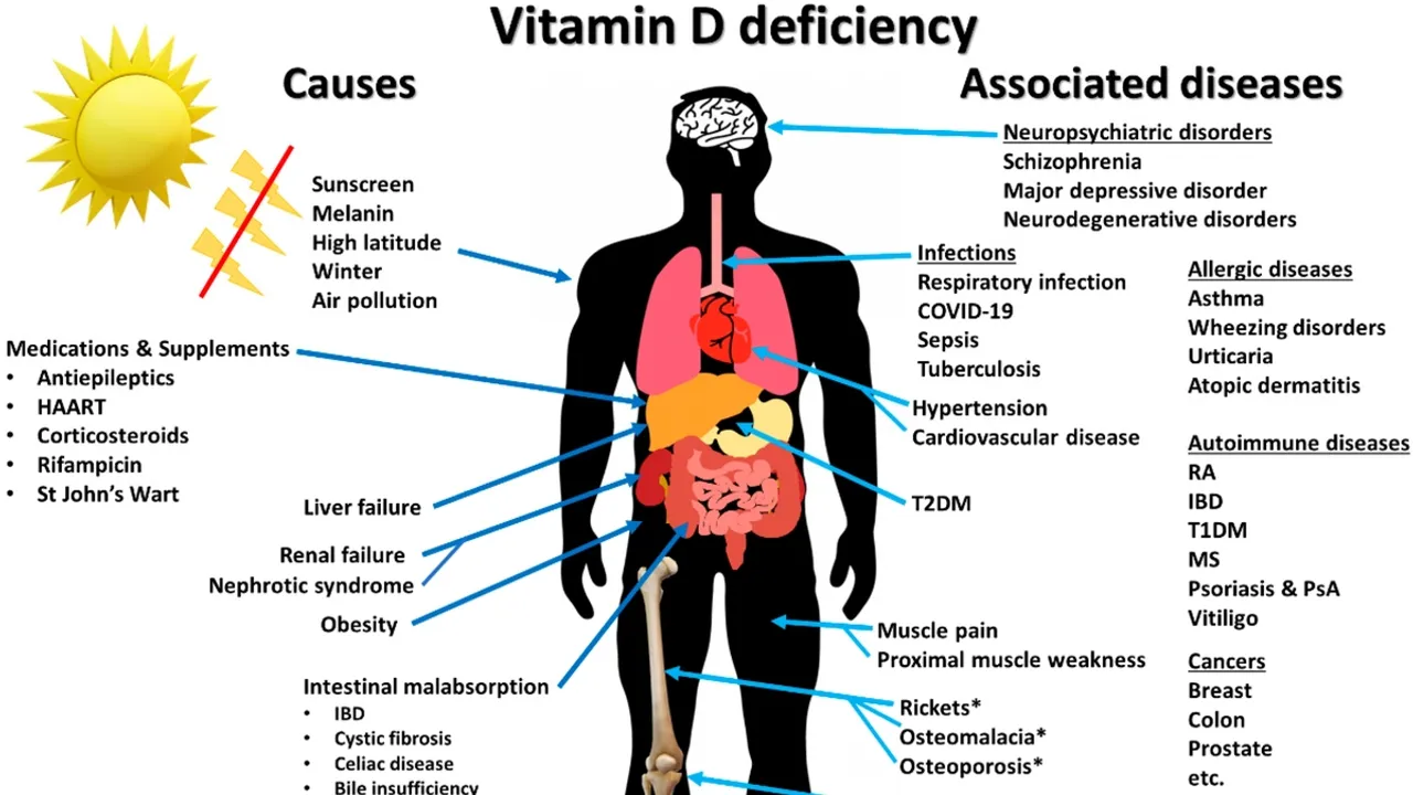Unveiling the Silent Epidemic: The Global Battle Against Vitamin D Deficiency