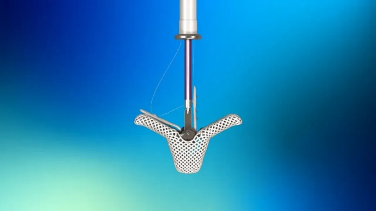 Abbott's TriClip device works by clipping together parts of the valve's leaflets to lower regurgigation (Photo credit: Abbott)
