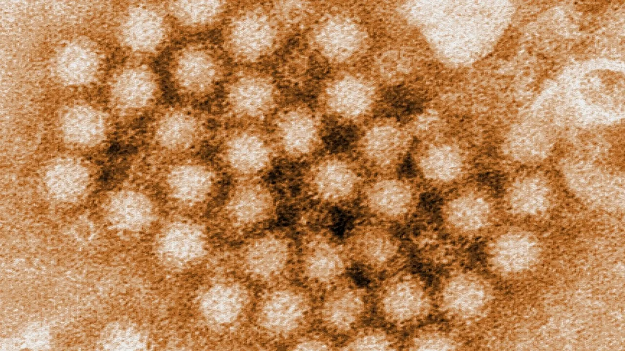 Surge in Norovirus Cases Hits the Northeast: A Closer Look at the Winter Vomiting Disease