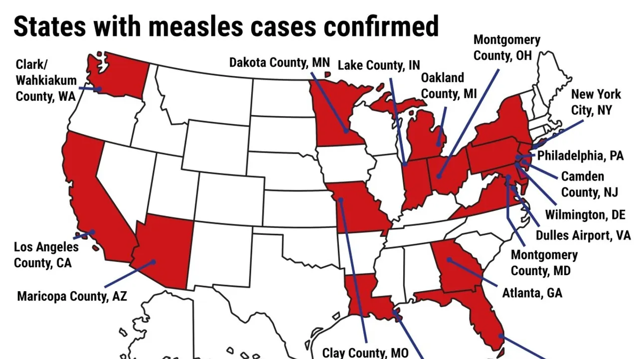 Florida's Measles Outbreak Sparks Concern Over Public Health Transparency and Vaccination Policies