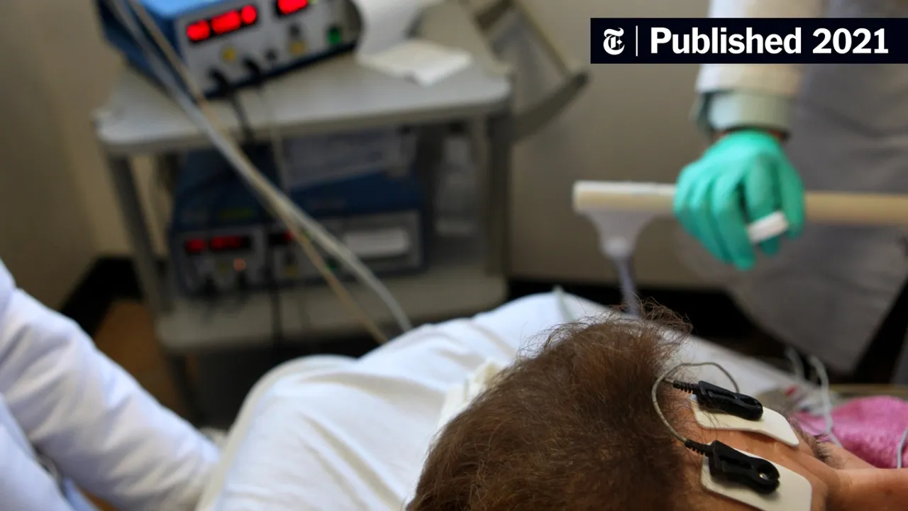 electroconvulsive-therapy-for-depression-research-20231206165857.jpg