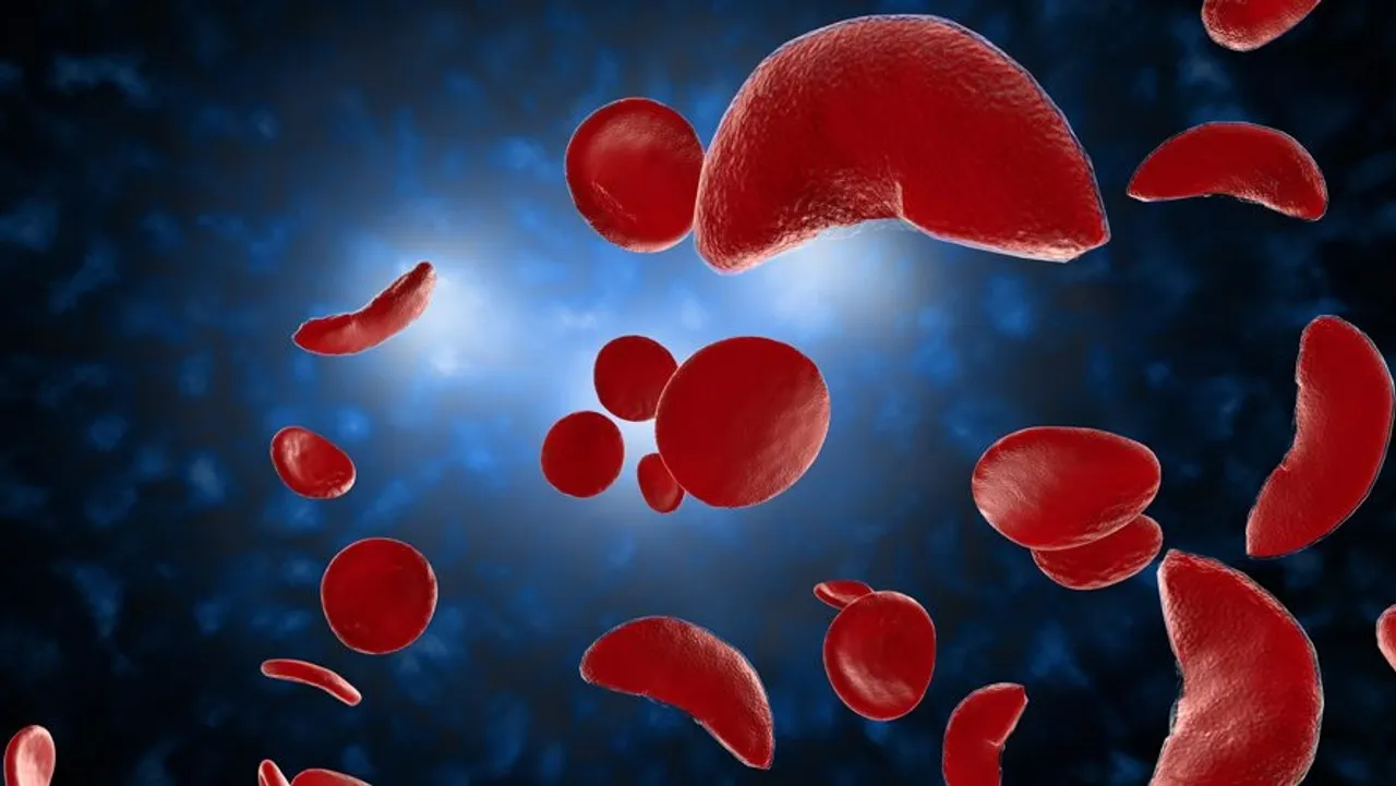 FDA Approves Groundbreaking CRISPR-Based Gene Therapy, Casgevy, for Sickle Cell Disease