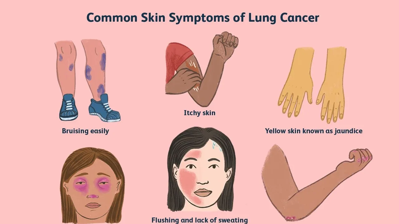 Understanding the Connection Between Itchy Skin and Cancer