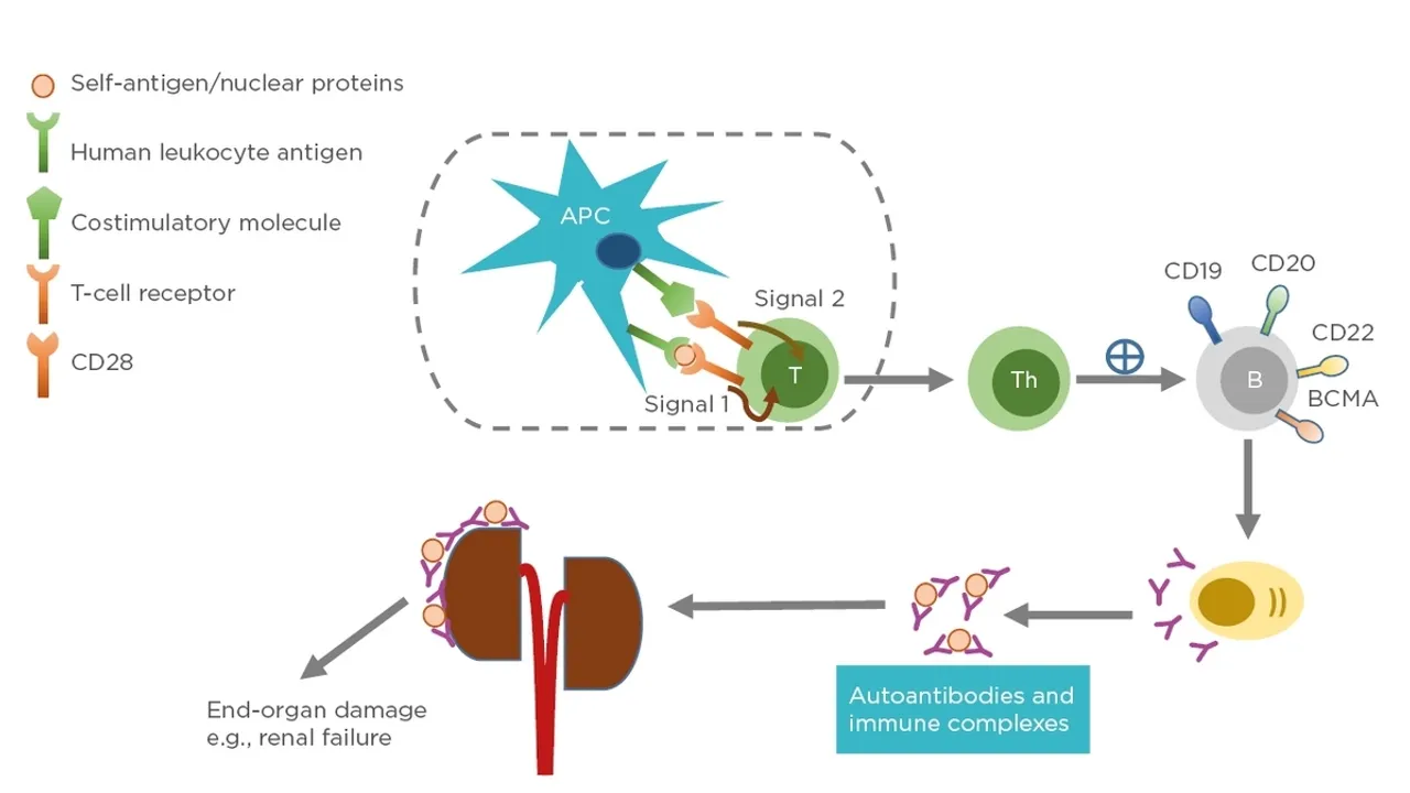 CD19 CAR TCell Therapy A Promising Approach in Severe Autoimmune