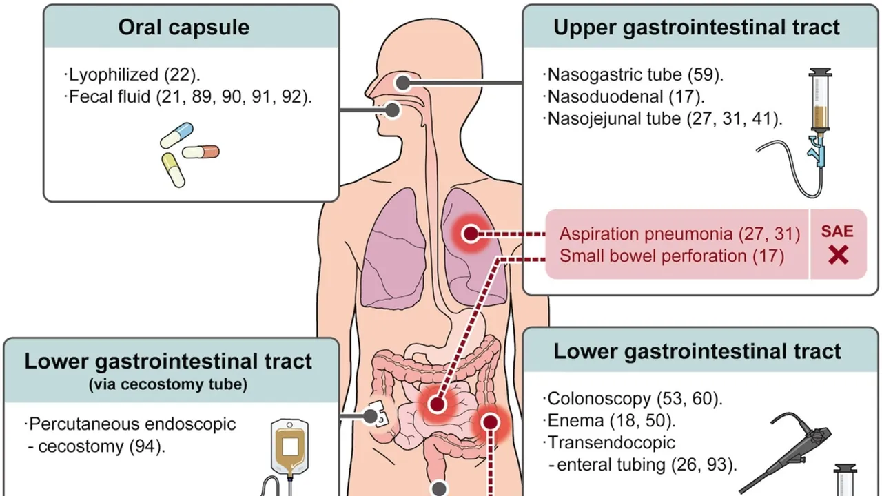 The Emerging Role of Fecal Microbiota Transplantation (FMT) in Treating GI Conditions
