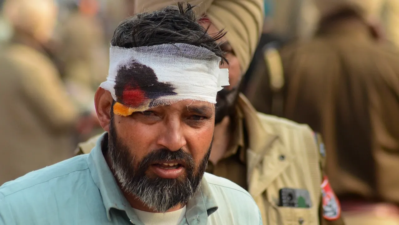 An injured farmer after police used tear gas shells to disperse them during their 'Delhi Chalo' march at Punjab-Haryana Shambhu border