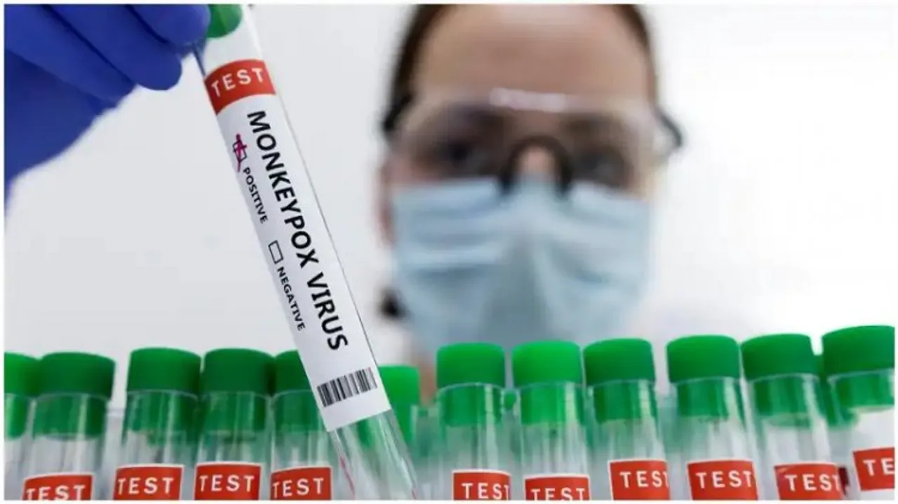 Holborn Wells India Develops Monkeypox Real-Time PCR Detection Kit