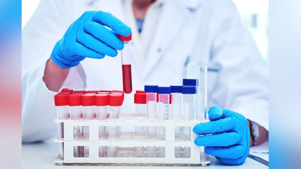 5 Signs You Require a CBC Test