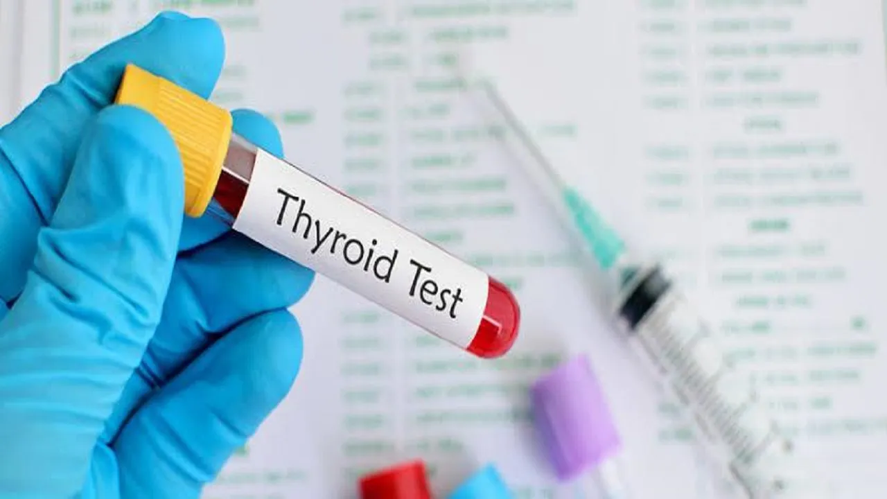 thyroid test