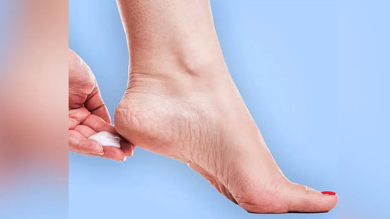 How to Heal Cracked Heels