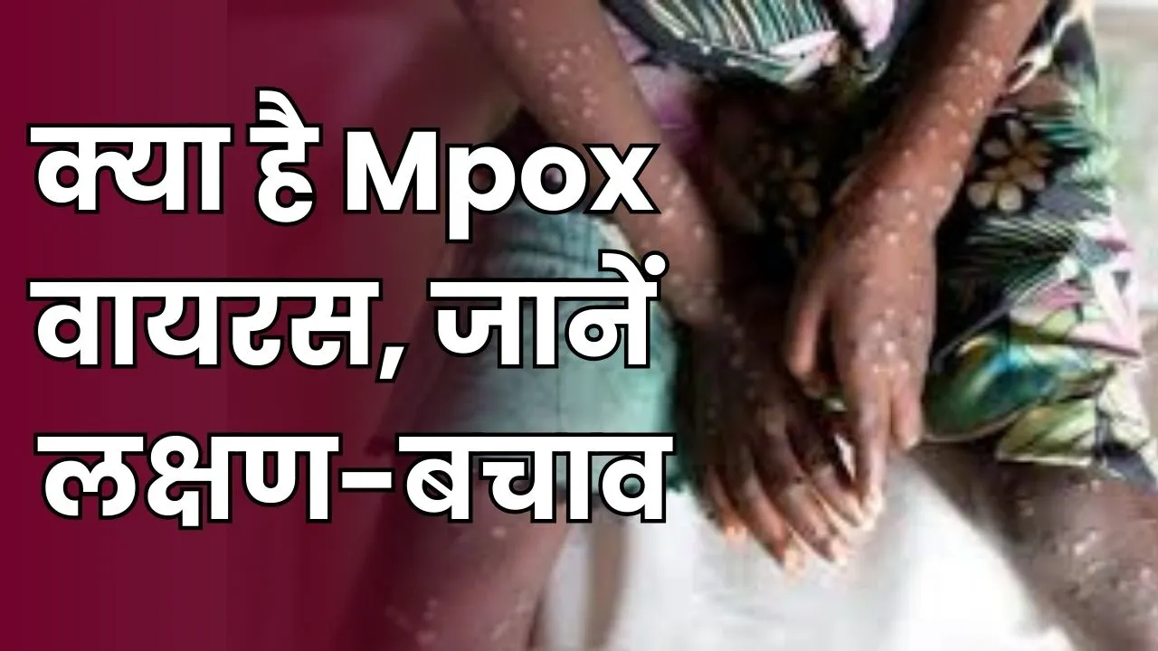 Mpox Virus News