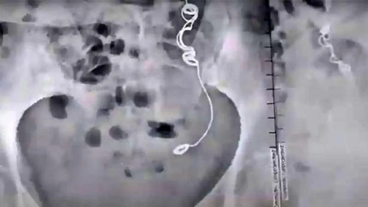 woman stomach
