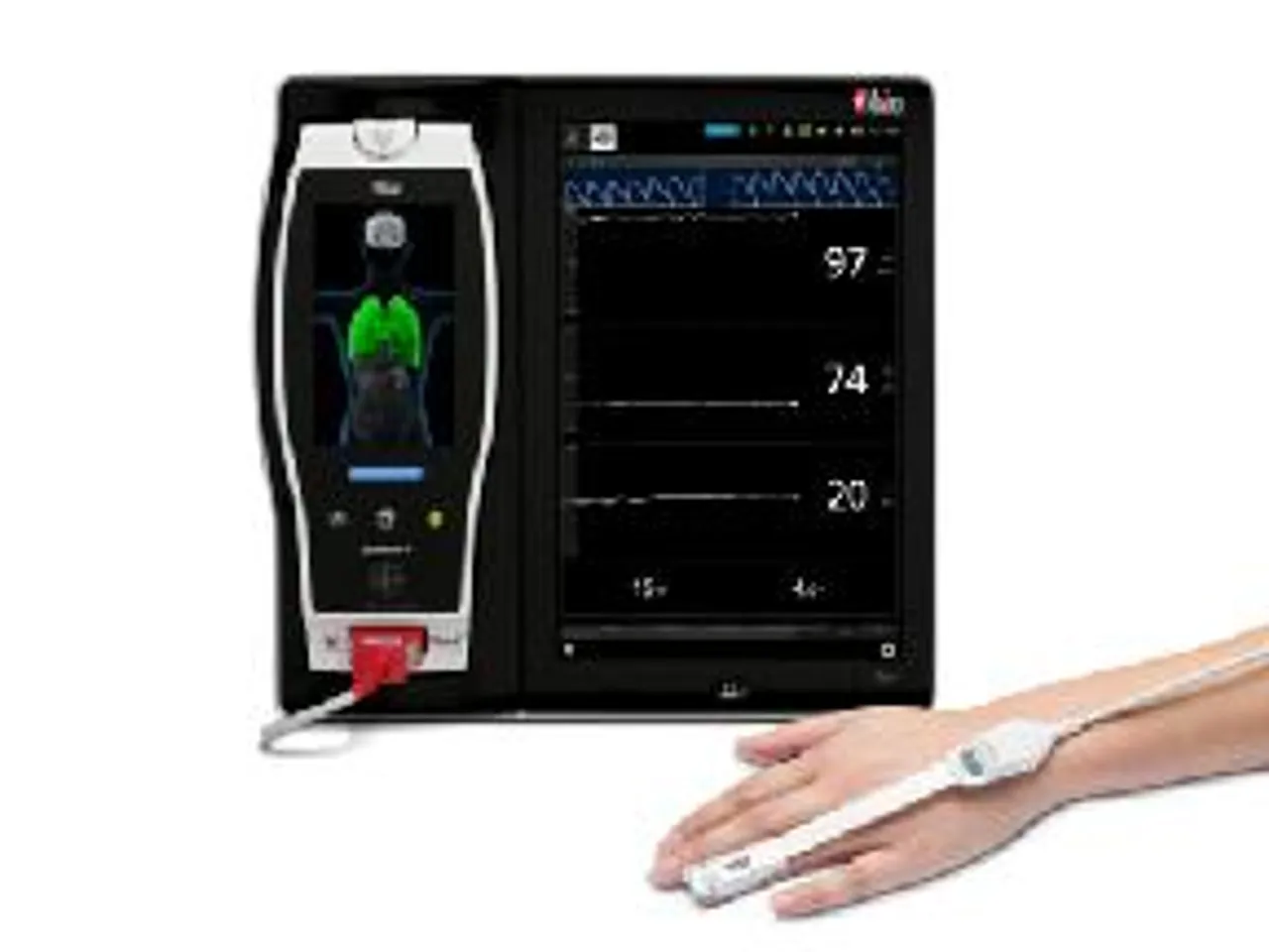 New Study Finds That Masimo PVi® Reliably Predicted Fluid Responsiveness in Young Children Undergoing Neurosurgery