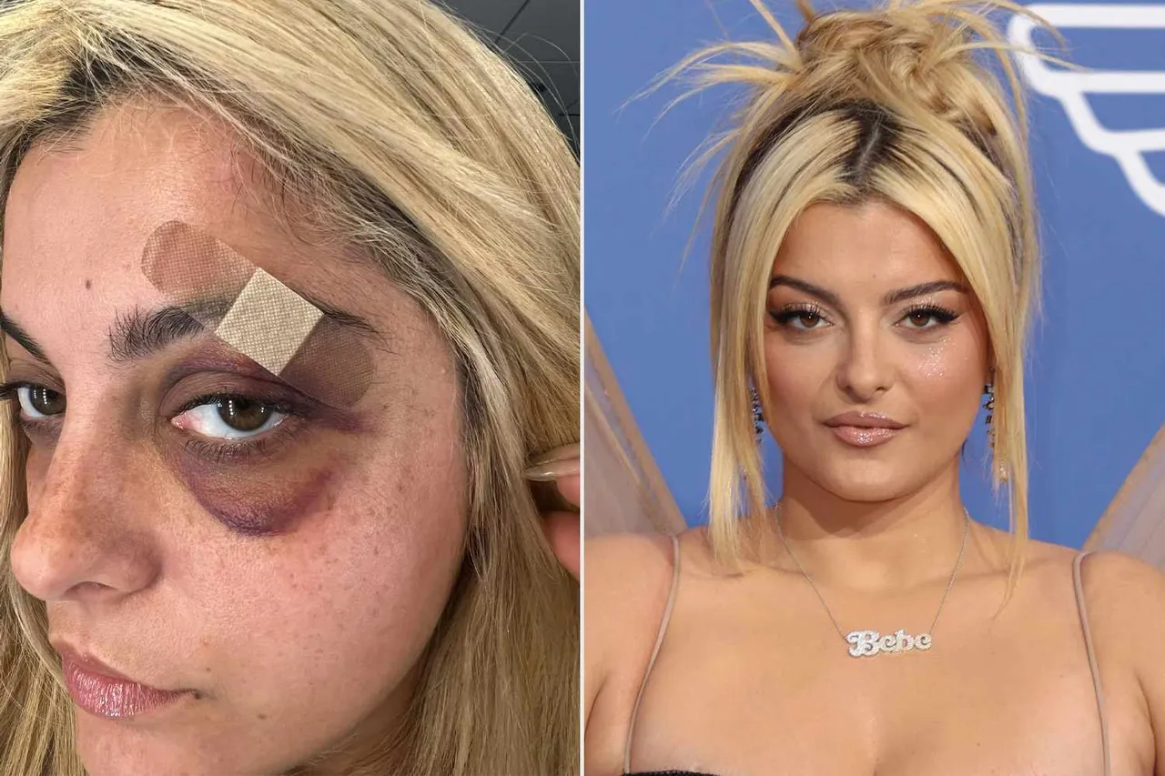 rexha.jpg