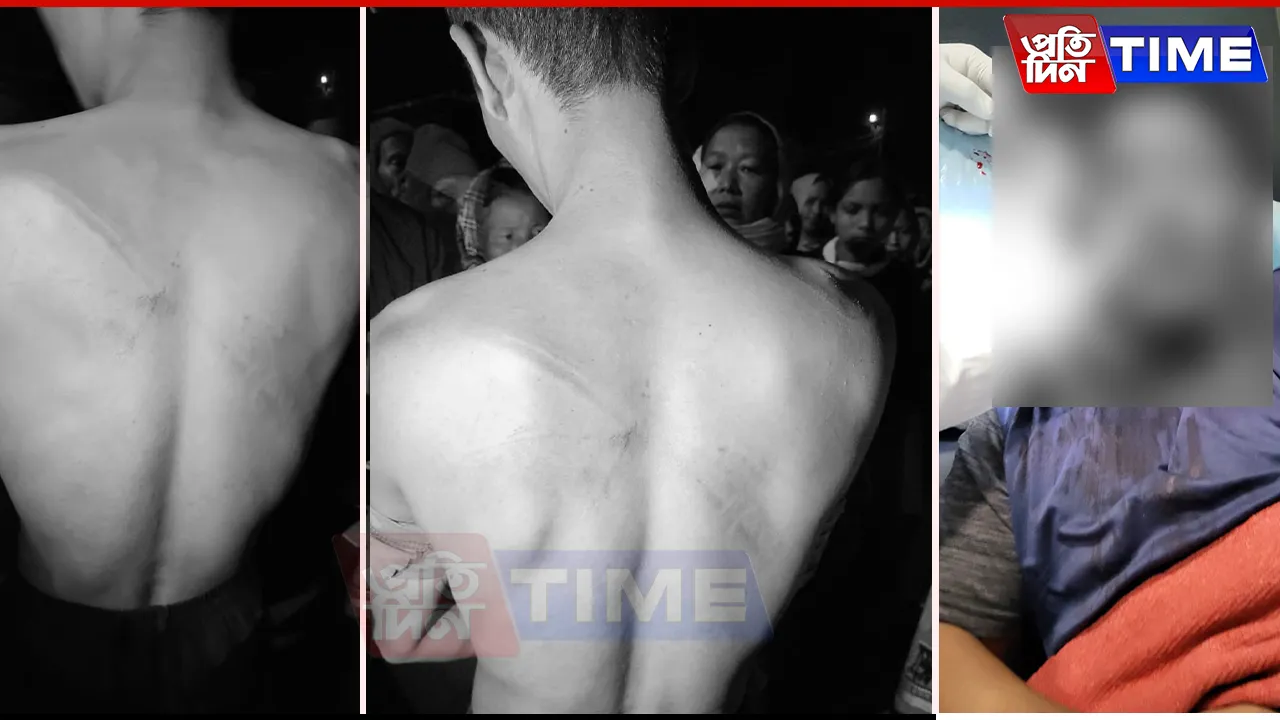 Several villagers sustained injuries in clashes at an Assam Rifles camp in Arunachal Pradesh's Changlang