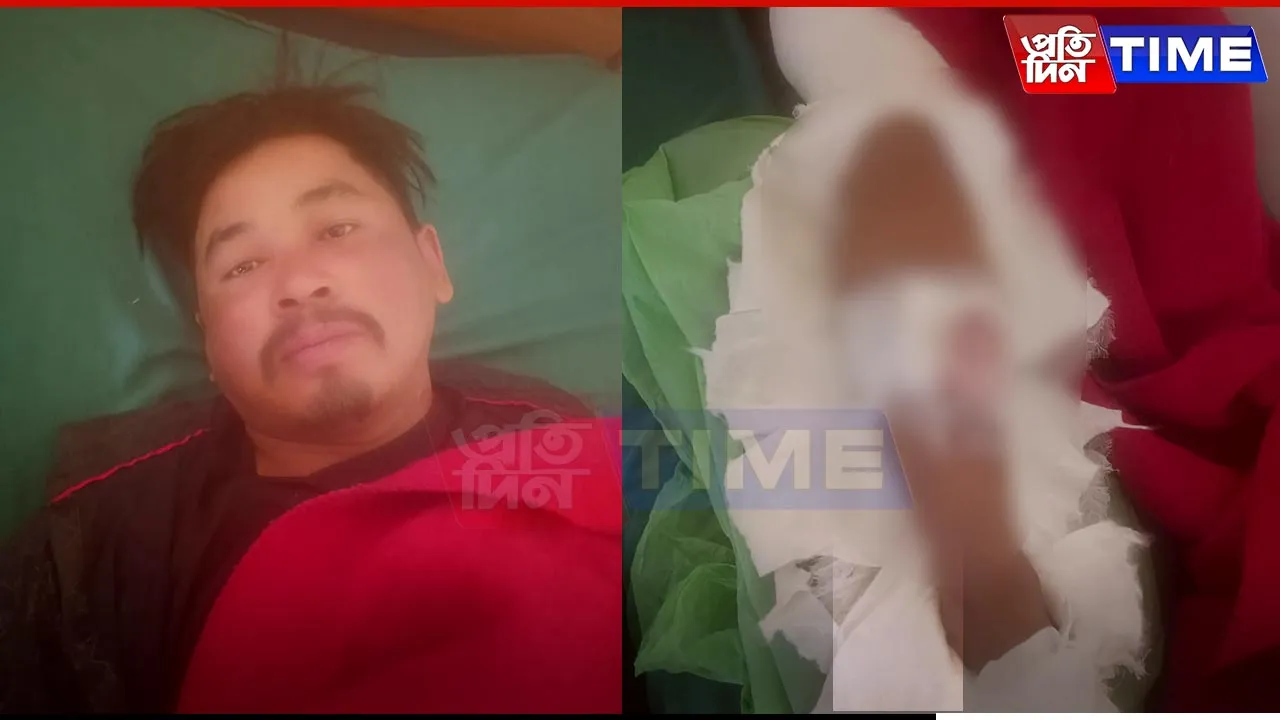 Notorious Dacoit Injured in Police Encounter at Jorabat