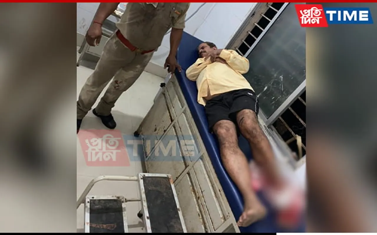 Assam: Criminal Injured in Police Firing in Behali