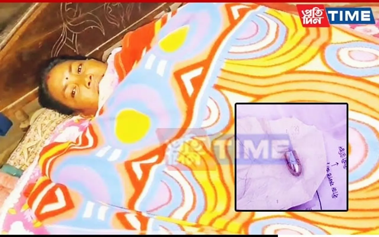 Assam: Miscreants Open Fire at Shop; Woman Sustain Minor Injuries