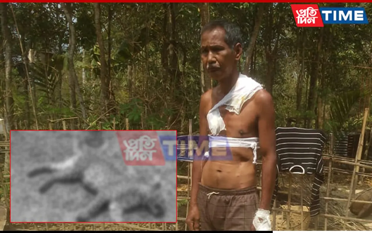 Leopard Attack Terrifies Man in Sivasagar; Carcass Discovery Raises Concerns in Golaghat