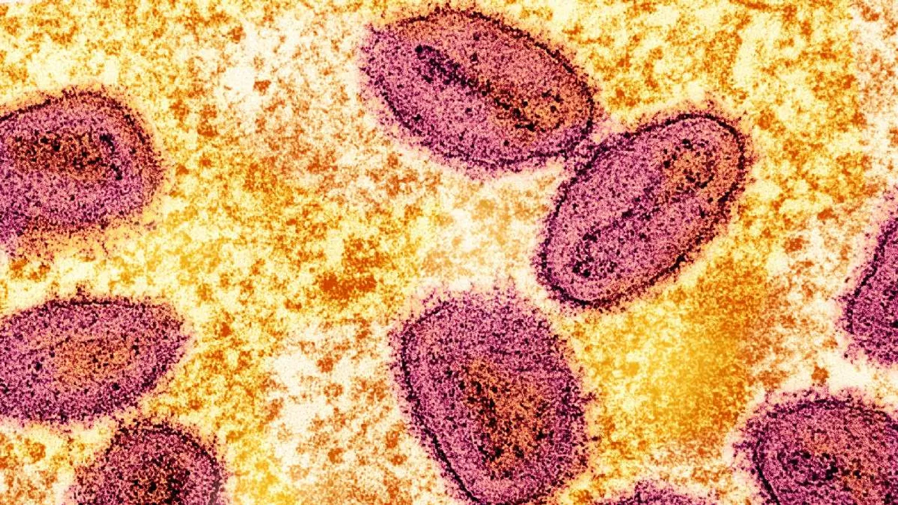 Mpox Scare: Airports, Ports, Borders Put on High Vigil In India