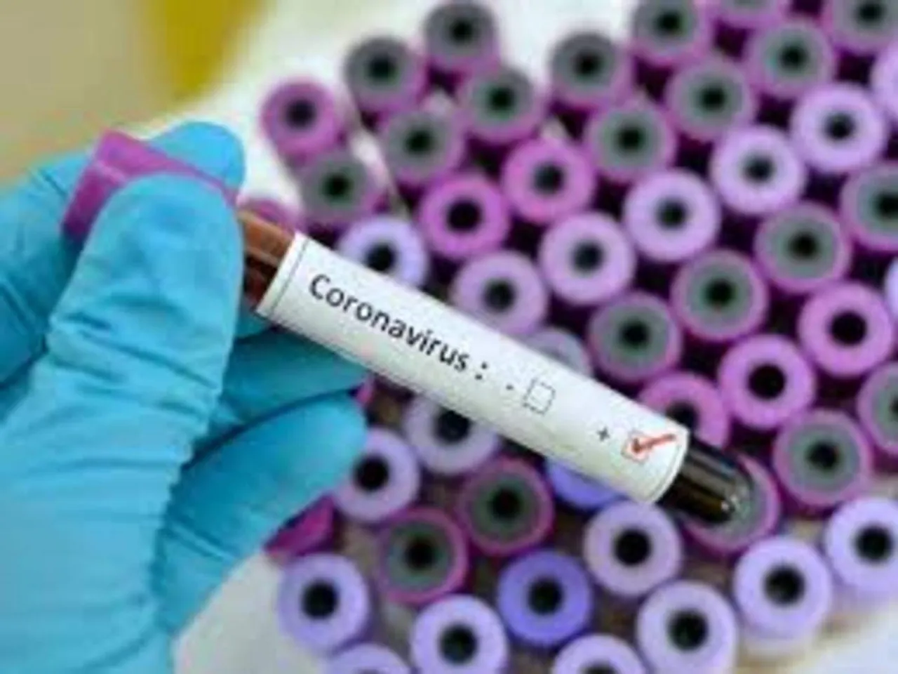 COVID-19: Assam Logs 8,339 New Cases, 15 Deaths